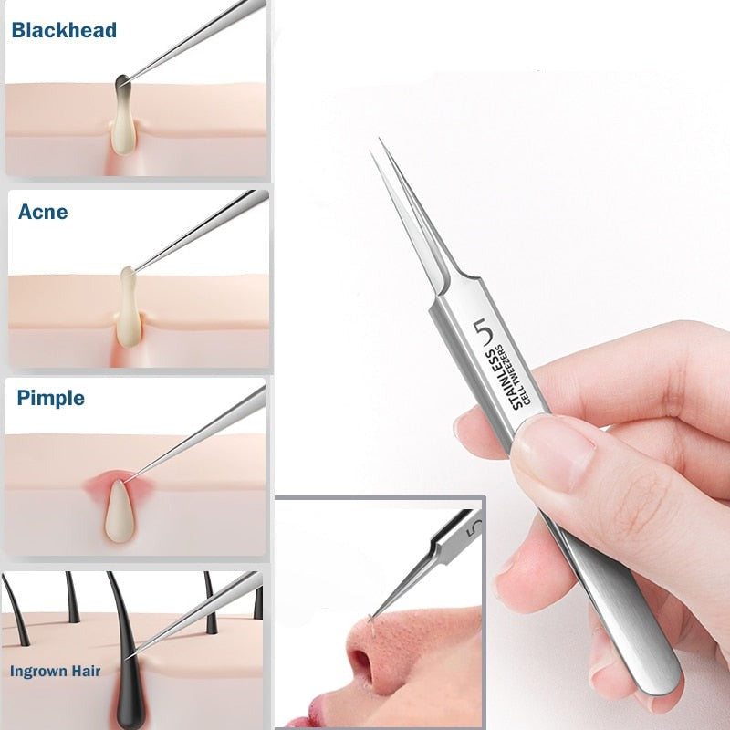 Ultra fine No. 5 Blackhead Pincet