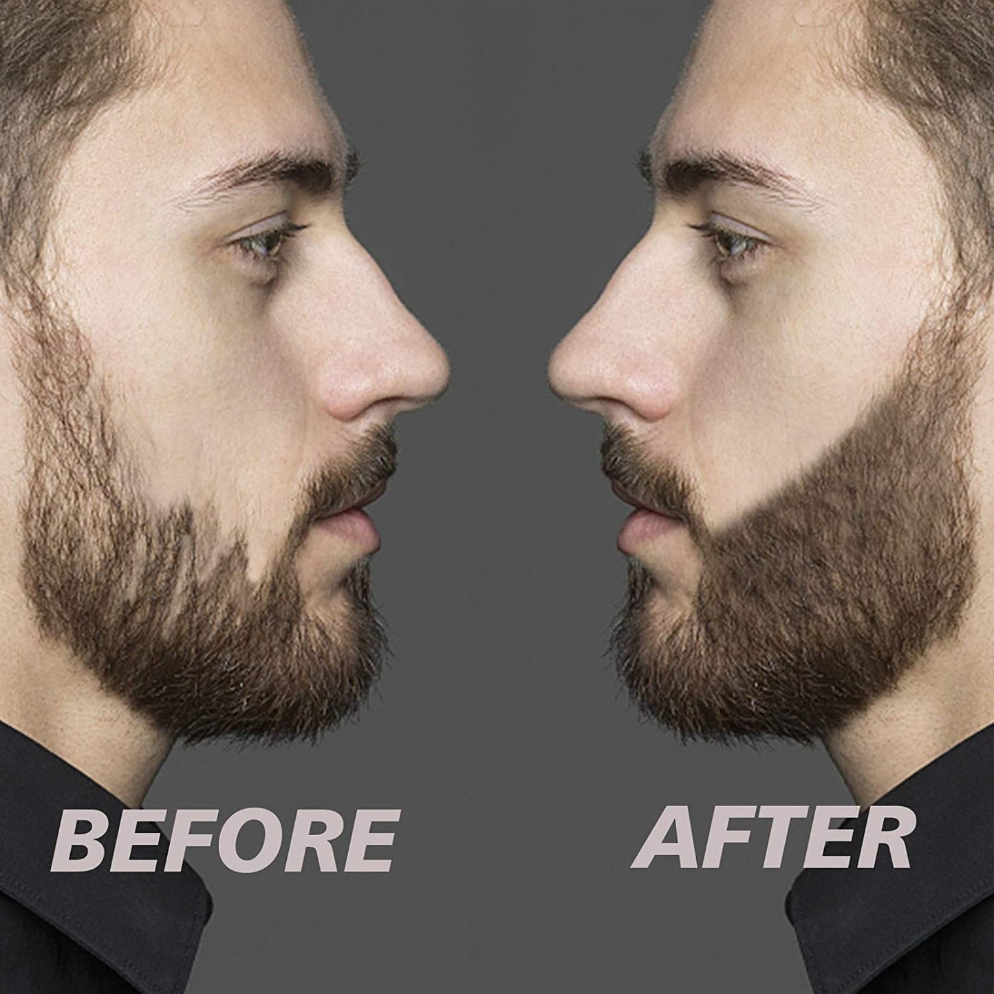 Beardfiller set - Strakke en vollere baard voor alle mannen!