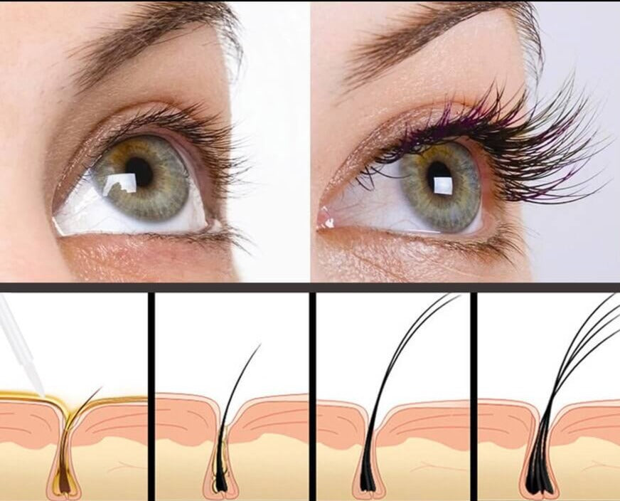 MaxLash - Wimper Groeiserum