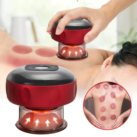 SmartCupperPro - Cupping op de meest ontspannende manier